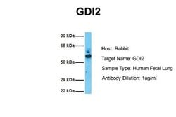GDI2 Rabbit anti-Human, Polyclonal, Novus Biologicals 0.1 mL | Buy Online | Novus Biologicals | Fisher Scientific